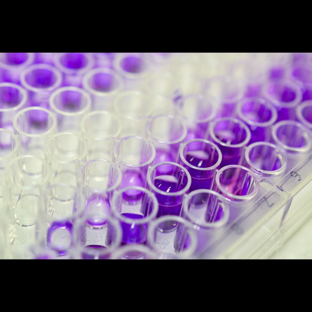 Human Myonectin CTRP15 ELISA Kit size: 96 Tests